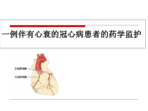 一例伴有心衰的冠心病患者的药学监护课件