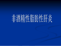非酒精性脂肪肝的临床诊断与治疗进展课件