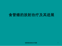 食管癌的放射治疗进展课件