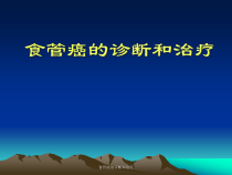 食管癌的诊断和治疗课件
