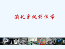 推荐医学影像诊断课件详解完整版消化系统