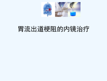 胃流出道梗阻的内镜治疗课件