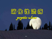 消化性溃疡医学课件