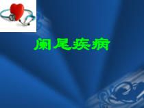 医学课件-阑尾炎课件