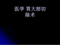 医学-胃大部切除术-课件