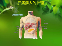 肝癌病人的护理医学课件