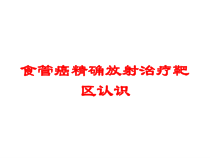 食管癌精确放射治疗靶区认识培训课件