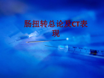 医学肠扭转总论及CT表现培训课件