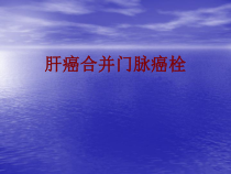 医学肝癌合并门脉癌栓培训课件