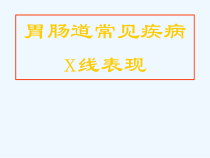 医学影像学消化系统常见疾病课件