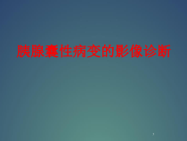 胰腺囊性病变的诊断医学课件