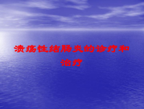 溃疡性结肠炎的诊疗和治疗培训课件