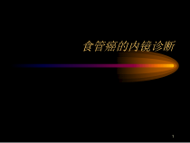 食管癌的内镜诊断医学课件