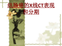 医学结肠癌的X线CT表现和分期培训课件