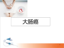 医学课件-大肠癌课件