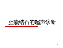 医学课件-胆囊结石的超声诊断课件