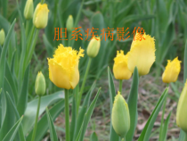 胆系疾病影像医学课件