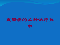 直肠癌的放射治疗技术培训课件