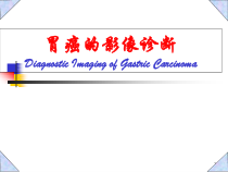 胃癌影像诊断医学课件