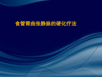 食管静脉曲张内镜治疗课件