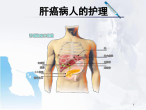 医学课件-肝癌病人的护理课件