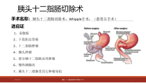 医学课件胰腺指肠手术麻醉ABC