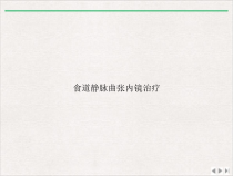 食道静脉曲张内镜治疗课件精美版