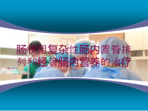肠梗阻复杂性肠内置管排列和经管肠内营养的治疗培训课件