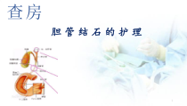 胆管结石护理查房医学课件