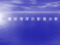 胆囊壁增厚医学课件