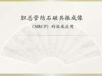 胆总管结石医学课件