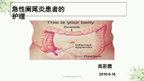 急性阑尾炎患者的护理课件