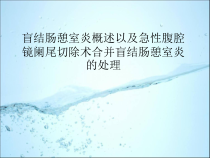 急诊腹腔镜阑尾炎合并盲结肠憩室的处理医学课件