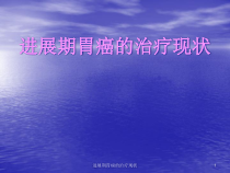 进展期胃癌的治疗现状课件