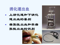 上消化道出血的内镜治疗课件
