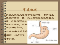 微创手术治疗胃癌的护理课件