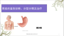 胃癌的鉴别诊断分型分期及治疗课件