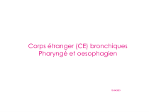 外教医学课件-CE-bronchiques-et-oesophage-支气管和食道