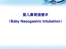 小儿胃管置入术医学课件