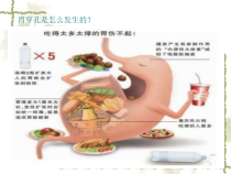 医学课件腹腔镜下胃穿孔手术配合