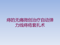 痔的无痛微创治疗自动弹力线痔疮套扎术培训课件