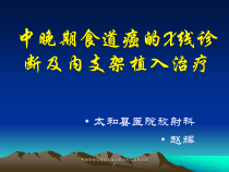 中晚期食道癌的X线诊断及内支架植入治疗课件