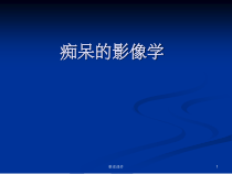 痴呆的影像学课件