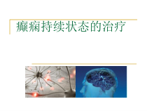 癫痫持续状态的治疗课件