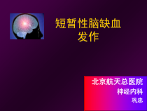 短暂性脑缺血发作课件