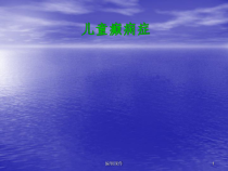 儿童癫痫课件