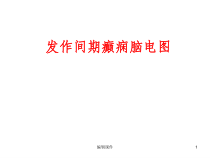 发作间期癫痫脑电图课件