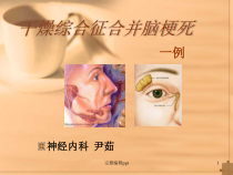 干燥综合征合并脑梗死课件