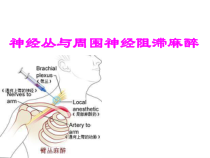 讲课稿周围神经阻滞麻醉课件