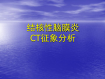 结核性脑膜炎CT征象分析医学课件